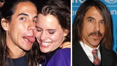 Anthony Kiedis