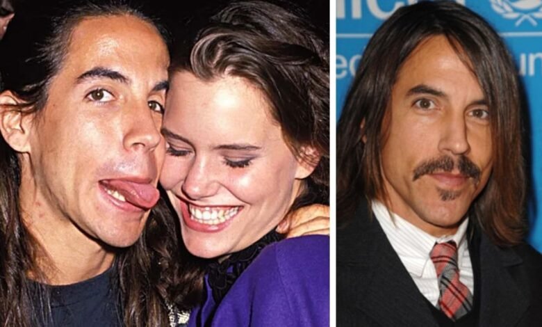 Anthony Kiedis
